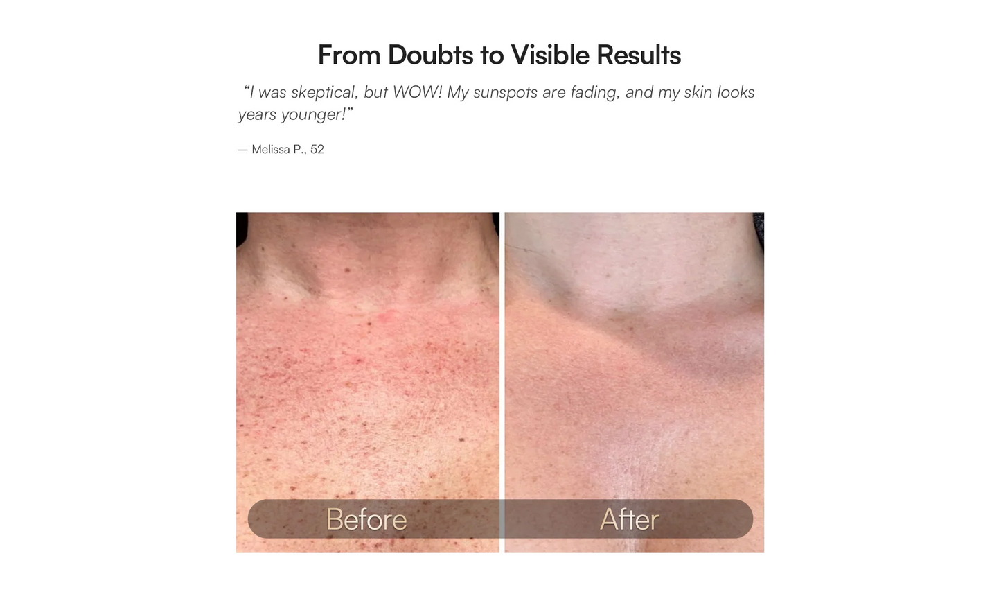 Neck & Chest Red Light Therapy