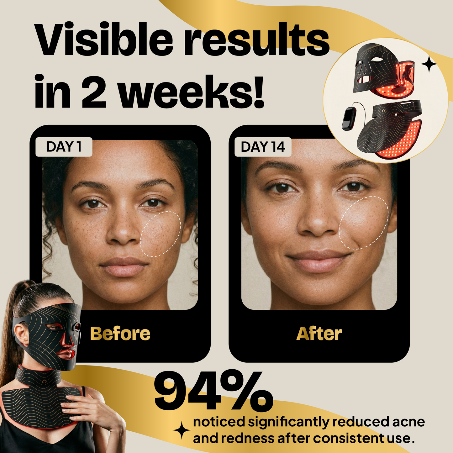 Red Light Therapy Mask