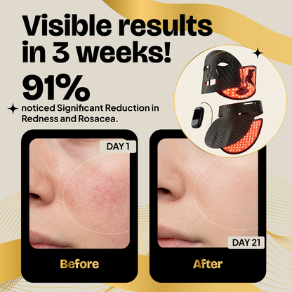 Red Light Therapy Mask