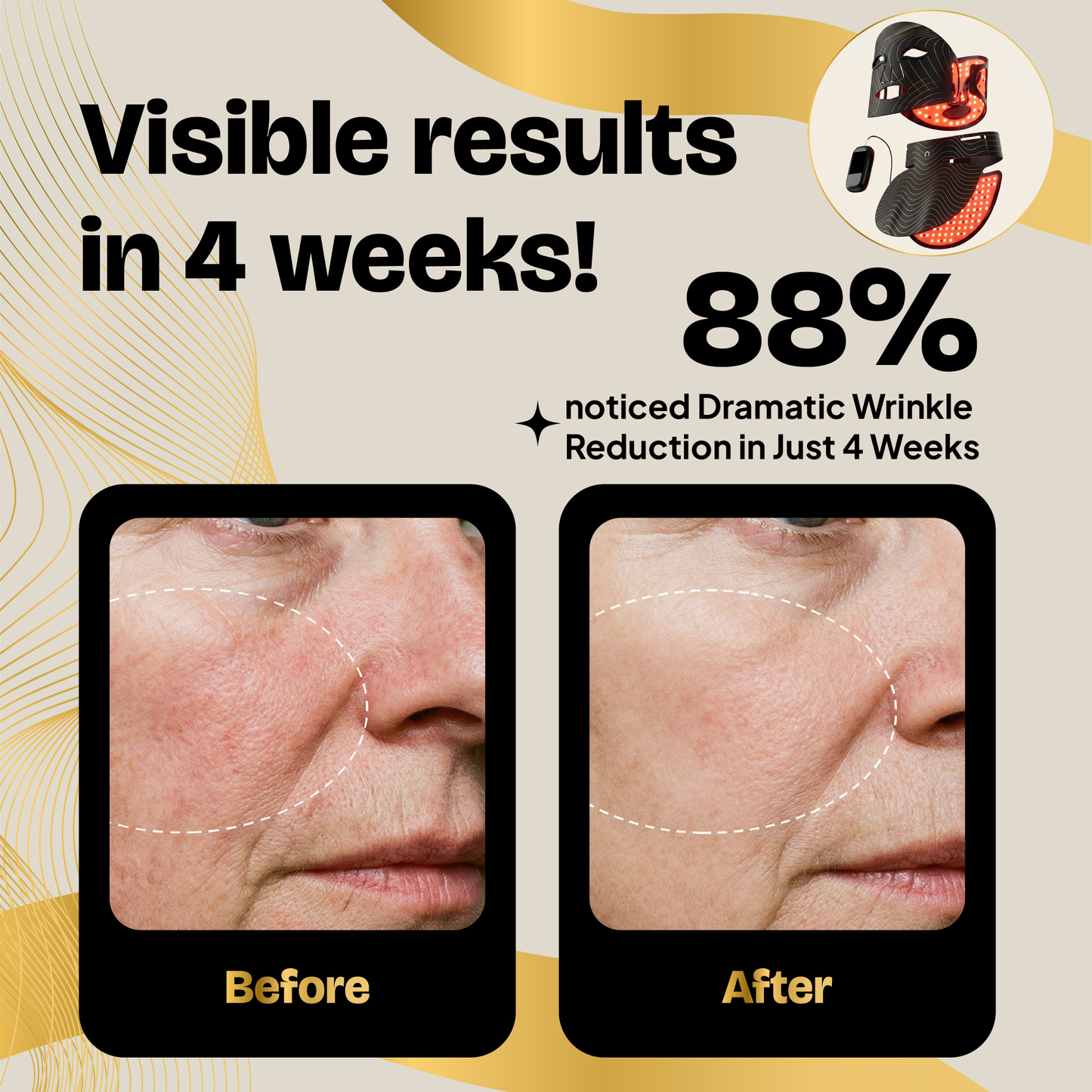 Red Light Therapy Mask